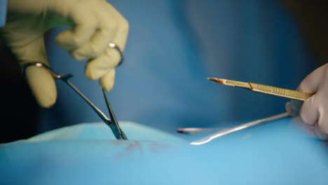 Cu-Chirurg-Operiert-Am-Patienten-Und-Entfernt-Blutige-Gaze