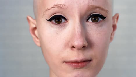 Portrait-of-a-sad,-depressed-woman-suffering-from-cancer-looking-into-the-camera