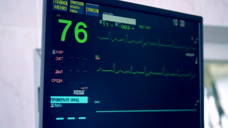 Speziellen-Monitor-zeigt-nach-Herzenslust-Zustand-während-einer-Operation.-4K.