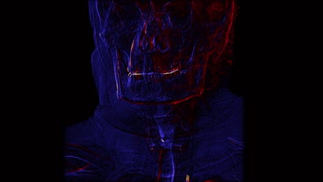 Blue-and-orange-cerebral-angiography-scan