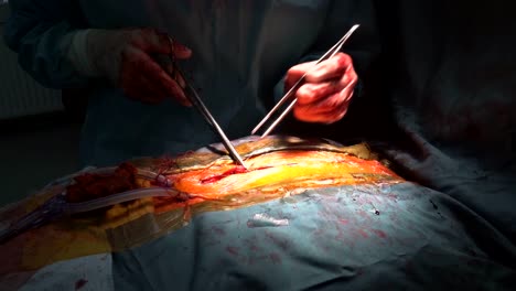 Suturing-after-the-cardiac-surgery-with-surgical-tools-and-tissues-close-up