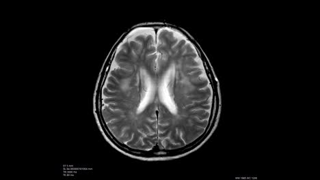 Brain-scan-image