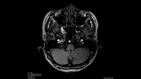 Gehirn-Scan-Bild