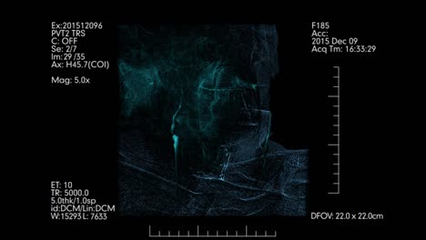 Medical-monitoring-of-brain-blood-vessels.-Cerebral-angiography.