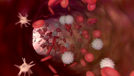 3D-animation-of-a-bloodstream-with-red-cell-white-cell-and-platelet