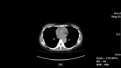 Abdominal-scan