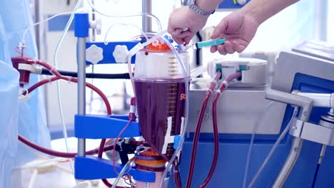 Dialysis-Medical-Device-Performing-Procedure-during-surgery.-4K.