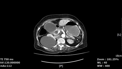 medical-ct-scan