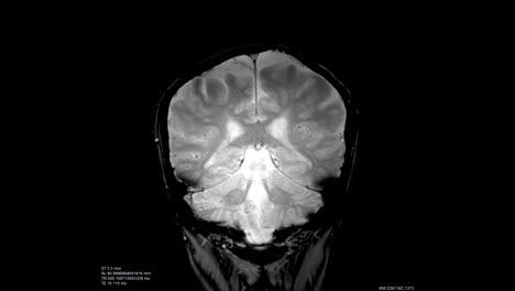 Brain-scan-image