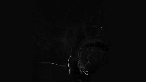 Black-and-white-side-view-Brain-vessels-angiography.