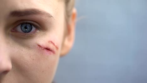 Defenseless-female-with-scars-on-her-face-looking-into-camera,-domestic-violence