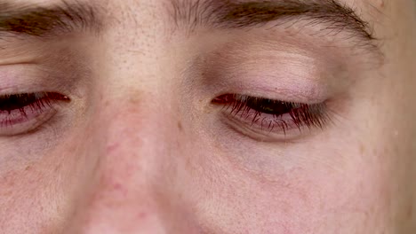 Cerca-de-dos-ojos-rojos-molesto-de-la-sangre-del-hombre-afectado-por-conjuntivitis,-o-después-de-la-gripe,-frío,-alergia.-Copiar-el-espacio-para-el-anuncio.-Ojos-cansados-después-de-trabajar-en-la-computadora.-Macro-y-Close-up-videos