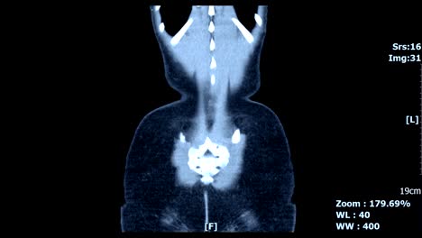 Body-front-scan-image