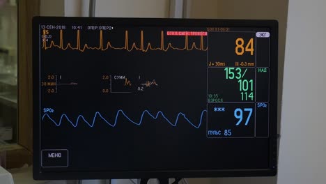 ECG-Monitor-zeigt-den-Zustand-des-Patienten-im-OP-Saal