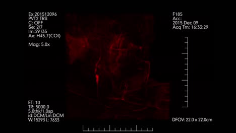 Red-colored-Medical-monitoring-of-brain-blood-vessels.-Cerebral-angiography.