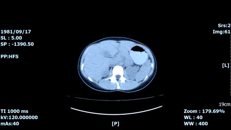 medizinische-Ct-scan