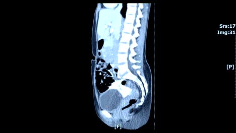 Body-inside-scan-image