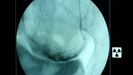 A-breathing-female-breast-on-a-big-blue-screen-of-a-modern-X-ray-device