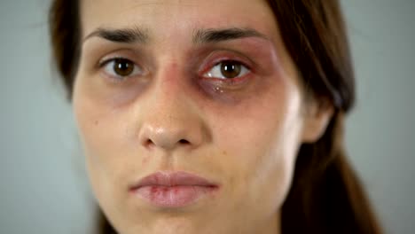 Hurt-lady-crying,-bruised-face-close-up,-domestic-violence-issue,-awareness