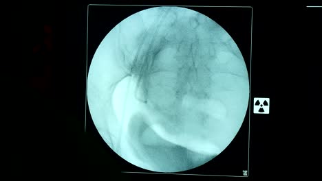 State-of-Art-Xray-Monitor-mit-einem-großen-blauen-Bildschirm-in-dem-schwarzen-Hintergrund