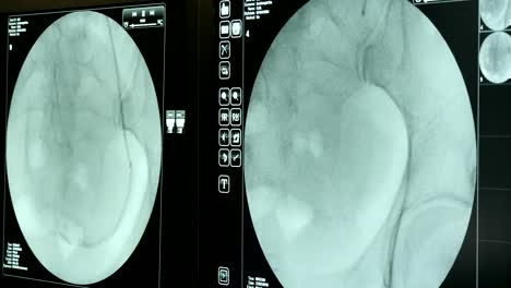 Moderno-aparato-de-rayos-comprueba-un-sistema-cardiovascular-de-un-paciente