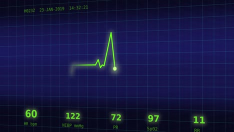 Latido-del-corazón-gráfico-en-el-monitor-de-7