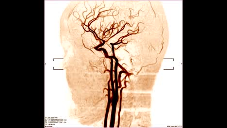 Blutgefäße-Scan-Bild