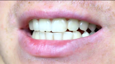 Primer-plano-de-los-dientes,-dientes-astillados