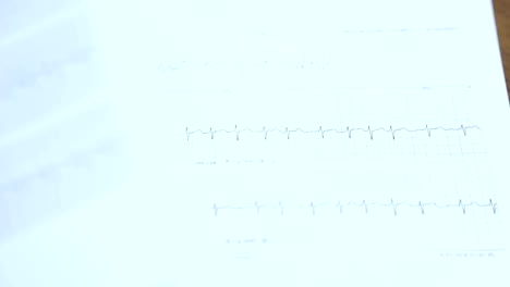 Analyse-der-Symptome.-Arzt-untersucht-das-kardiogramm