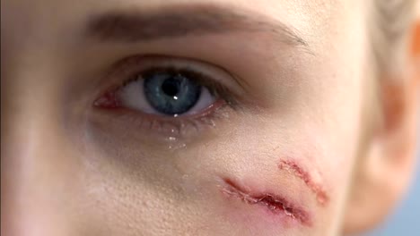 Injured-crying-woman-with-wound-on-face-close-up,-domestic-violence,-first-aid