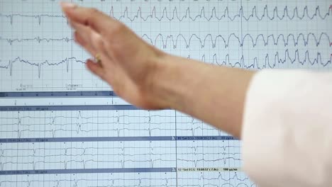 Cardiac-heart-disease-on-a-computer-close-up