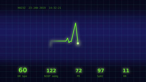 Latido-del-corazón-gráfico-en-el-monitor-6