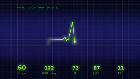 Herzschlag-Diagramm-auf-dem-Monitor-6