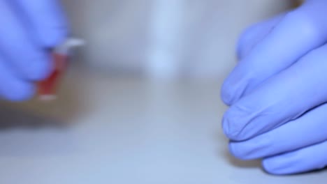 Técnico-de-laboratorio-manteniendo-la-pipeta-y-muestras-de-sangre-en-sala-del-hospital-para-transfusión-de-sangre,-las-manos-cerca-para-arriba.-Closeup-de-médico-sosteniendo-el-tubo-de-ensayo-de-la-sangre.-SIDA-/-VIH-Hospital-prueba-de-sangre.