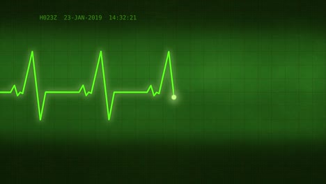 Heart-beat-chart-on-the-monitor-4