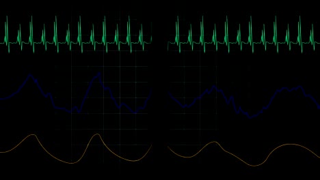 Simulation-der-Herzfrequenz-medizinische-Maschine