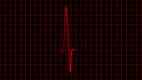 Kardiogramm-Cardiograph-Oszilloskop-Bildschirm-Schleife-4k