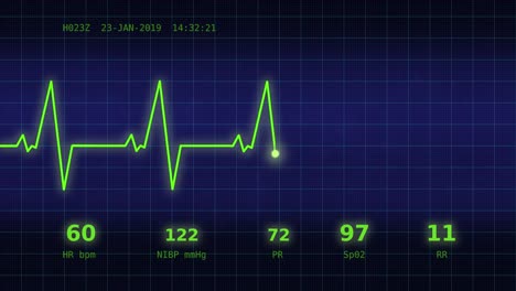 Herzschlag-Diagramm-auf-dem-Monitor-1