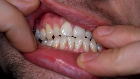 un-hombre-muestra-sus-dientes,-que-se-separa-sus-labios-de-los-dedos,-primer-planos