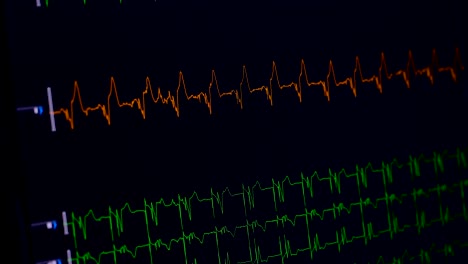 Medical-heart-monitor-measuring-ecg.