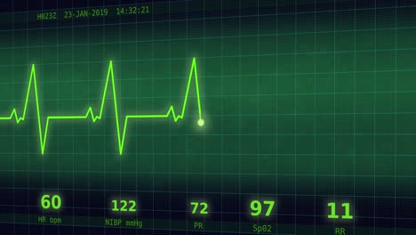 Latido-del-corazón-gráfico-en-el-monitor-2