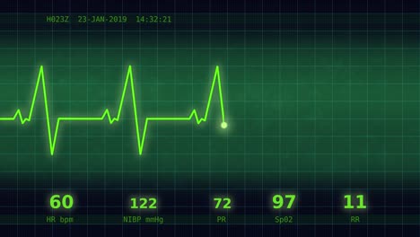 Herzschlag-Diagramm-auf-dem-Monitor-3