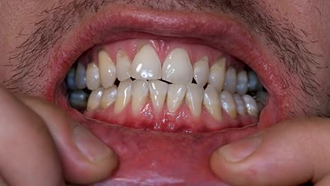 un-hombre-muestra-sus-dientes,-que-se-separa-sus-labios-de-los-dedos,-primer-planos