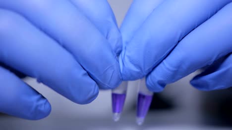 Close-up-of-hands-of-scientist-in-gloves-holding-pipette-and-pouring-solutions-into-test-tube.-GMO.-DNA.-Medical-worker-.-Student-used-laboratory-vessels-in-experiments.-Work-in-the-laboratory