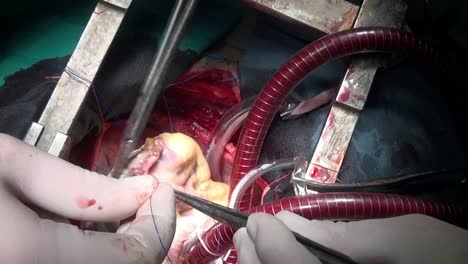 Heart-with-surgical-thread-during-operation-on-live-organ-of-patient-in-clinic.