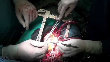 Chirurg-näht-Sie-Herz-mit-atraumatischen-Nahtmaterial-während-des-Betriebs.
