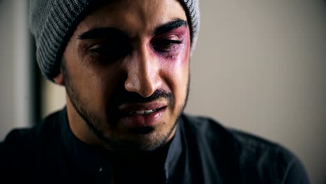 Young-man-beaten-and-wounded-cries-looking-at-the-camera,close-up