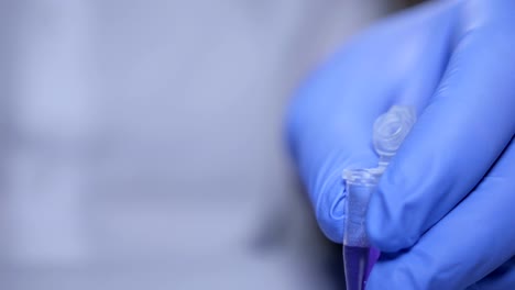 Close-up-of-hands-of-scientist-in-gloves-holding-pipette-and-pouring-solutions-into-test-tube.-GMO.-DNA.-Medical-worker-.-Student-used-laboratory-vessels-in-experiments.-Work-in-the-laboratory