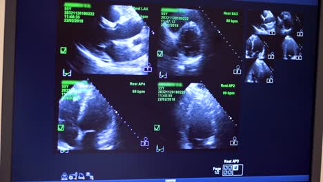 Radiology,-x-ray-scanner.-Data-changing-to-screen.-Close-up.