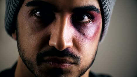 beaten-and-wounded-young-man-staring-at-the-camera,close-up